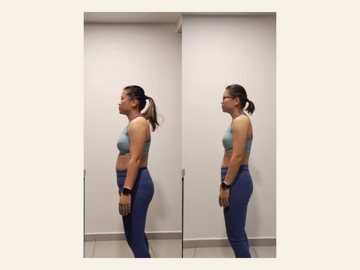 Rachel progress photo